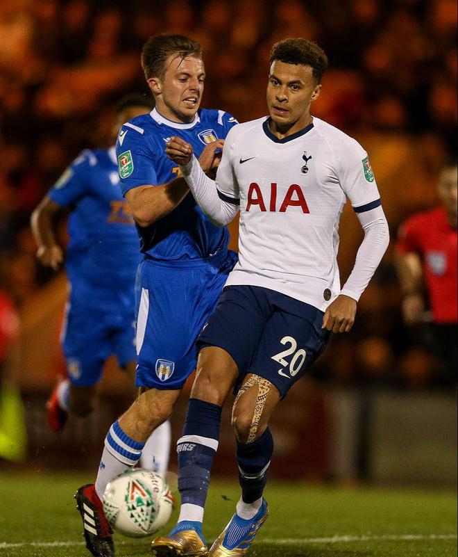 独行侠队记：浓眉表示他计划出战明天对阵火箭的背靠背比赛